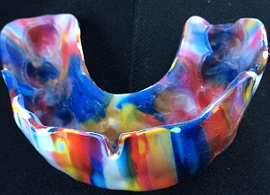 pacs_mouthguard_150409_300w.jpg