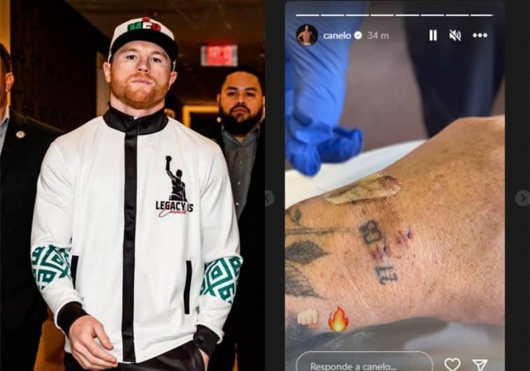 canelo-vendaje-puntos-758x531.jpg