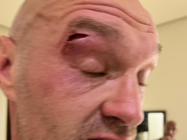 tyson-fury_1706897147.jpg