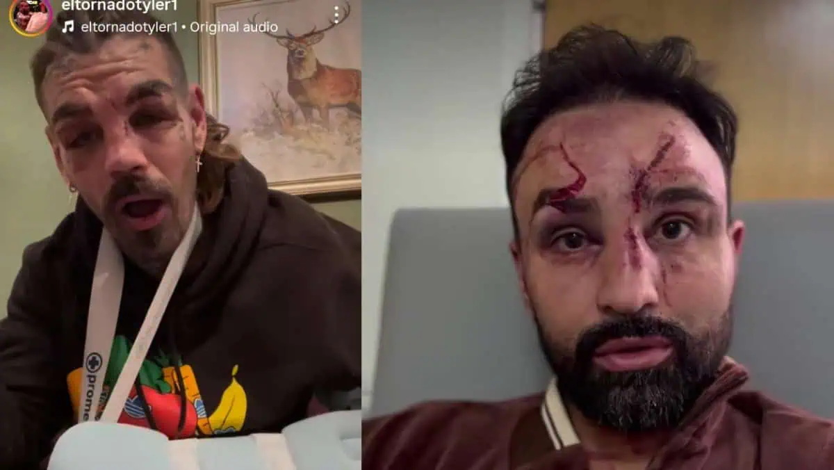 Malignaggi-vs-Goodjohn-injuries_ͼ.jpg