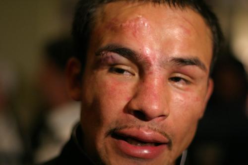 PacquiavsMarquezII151.JPG