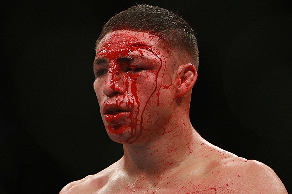 ĩٰUFC 107СͯBJ Penn TKO &quot;ج&quot; .ɣ˹.ڵ.ɣ˹