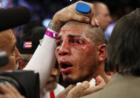 ͷæˡбдѪ󣬿ΪCutman Miguel Diazרҵˡε